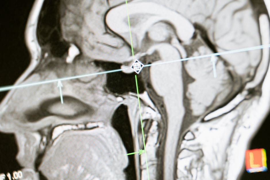 Is Your CT Scan Hiding a Heart Attack? New AI Can Now See What Doctors Miss